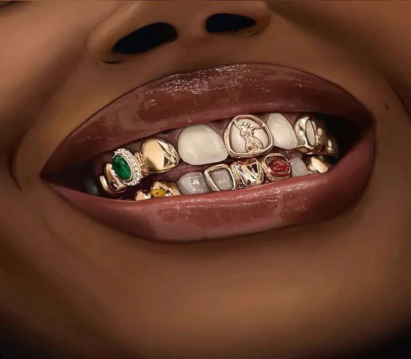 نگین دندان طلا
