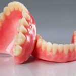 فرق ایمپلنت با دندان ثابت چیست؟