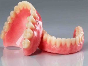 فرق ایمپلنت با دندان ثابت چیست