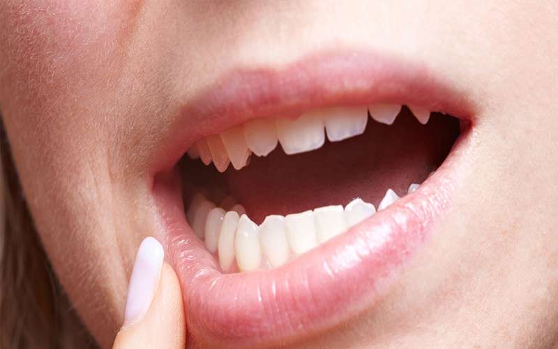 درمان خانگی دندان درد سینوسی