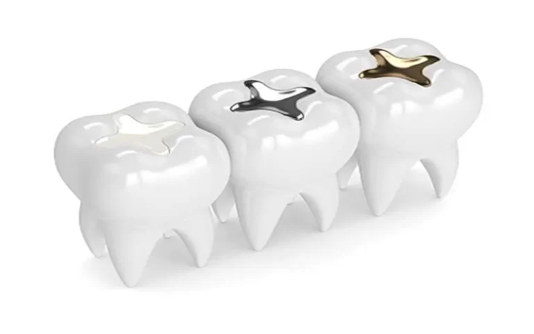 پرکردن دندان با مواد سفید یا سیاه