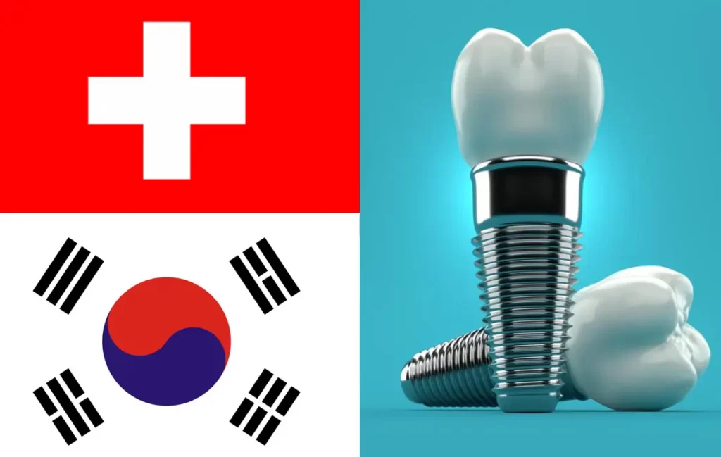 مقایسه ایمپلنت کره ای و سوئیسی